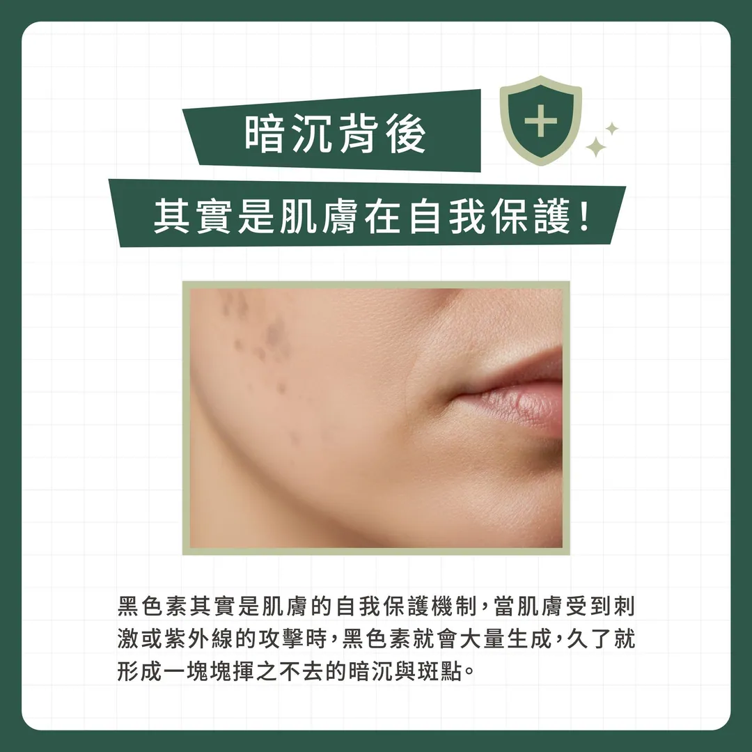 快速了解肌膚黑色素沉澱 第 2 張